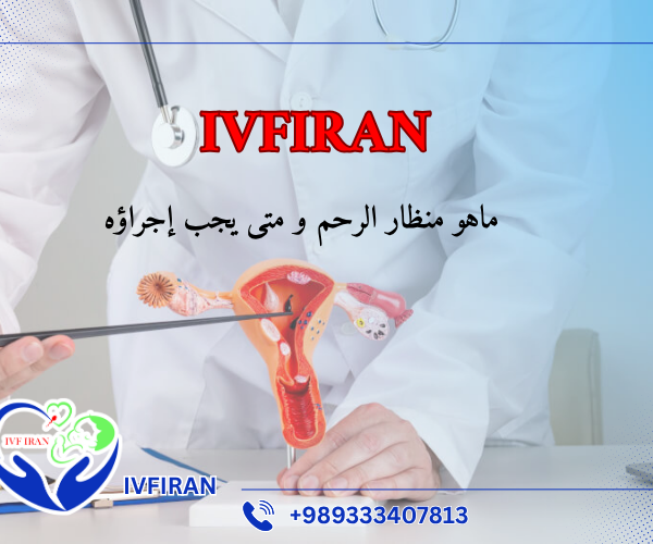 منظار الرحم