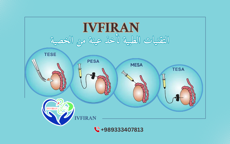 عينة الخصية