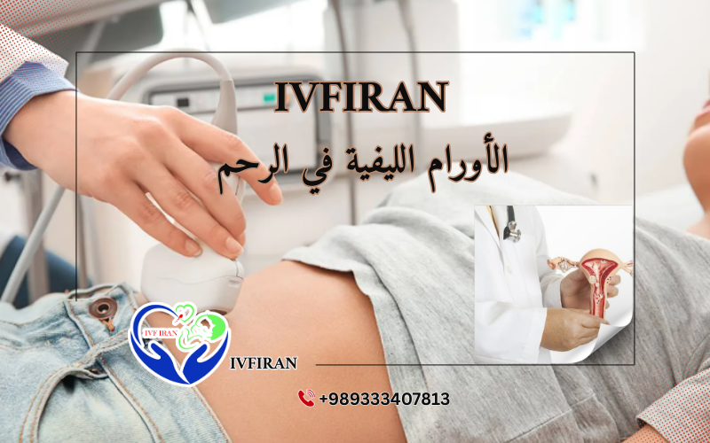 الأورام الليفية في الرحم