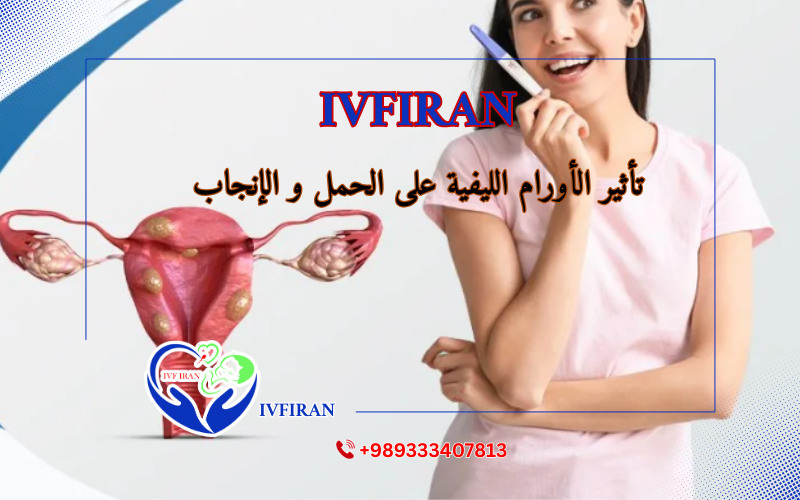 الأورام الليفية