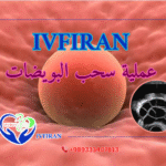 عملية سحب البويضات